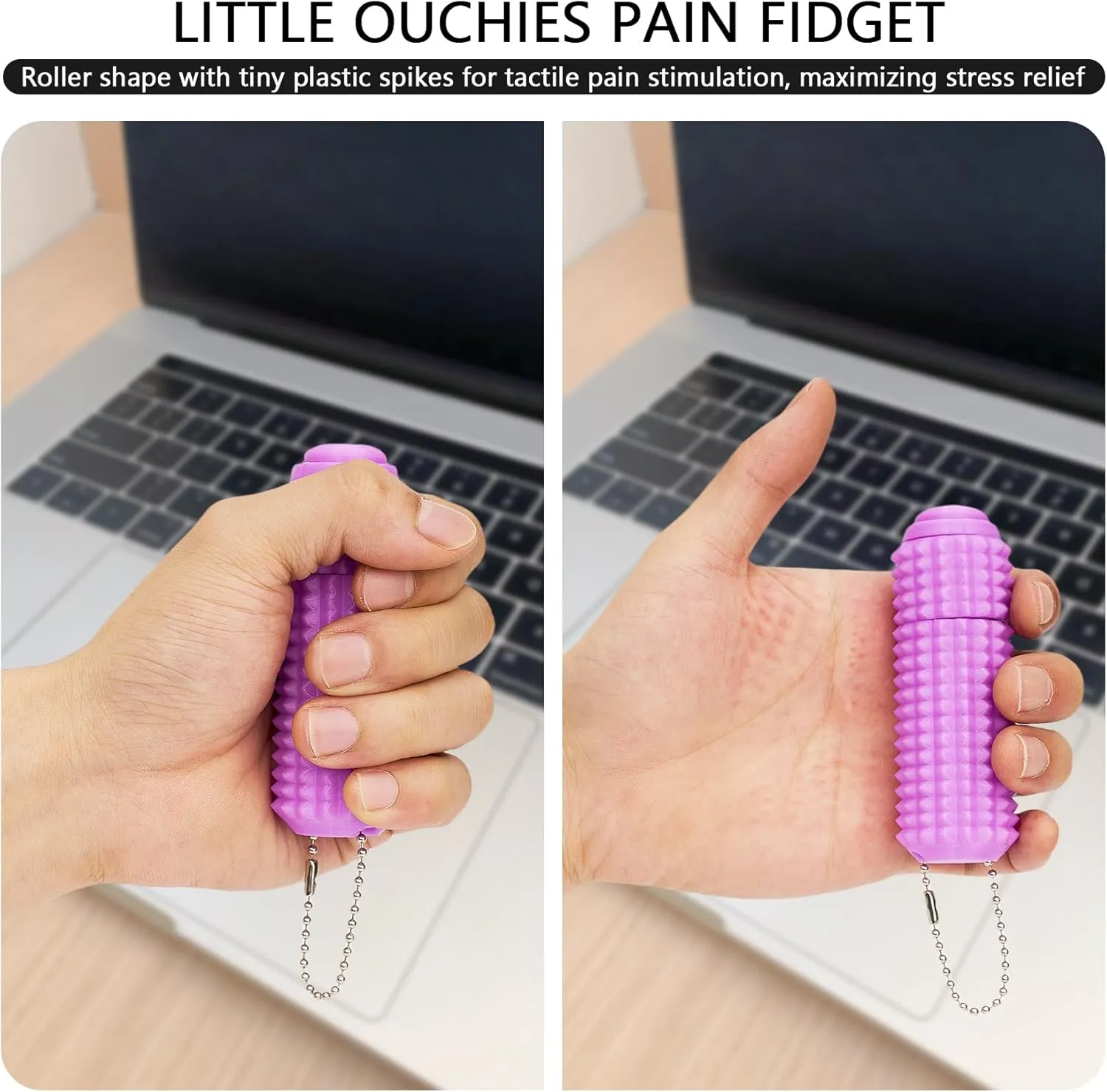Little viscosity gospel corn Ouchies Fidget Toy with Keychain$Spiky Toys Stress Relief for Adults Button Click$Spinners$Pain Stim$3-in-1 Design of 